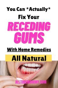  receding gums