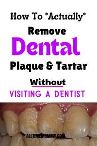 dental plaque self care